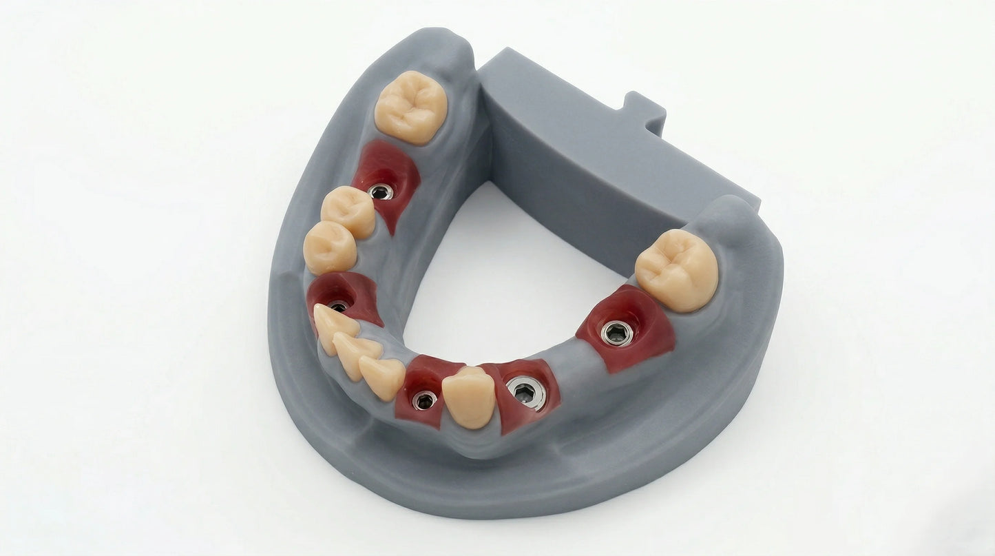 Dental High Precision Implant Model 3D Printing Resin