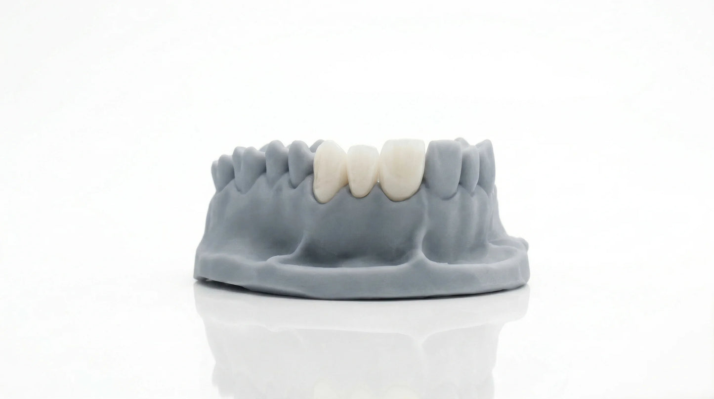 Dental Permanent Crown 3D Printing Resin (55% Ceramic Powder, Shade A1)