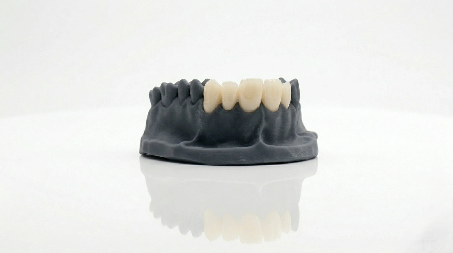 Dental Temp C&B Crown 3D Printing Resin