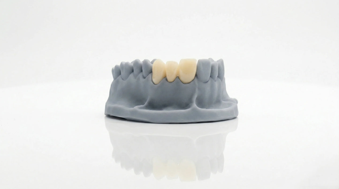 Dental Temp C&B Crown 3D Printing Resin